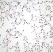 小鼠肺組織感染無PB2適應性變異的禽流感病毒。
